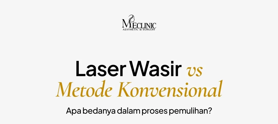 LASER WASIR VS METODE KONVENSIONAL