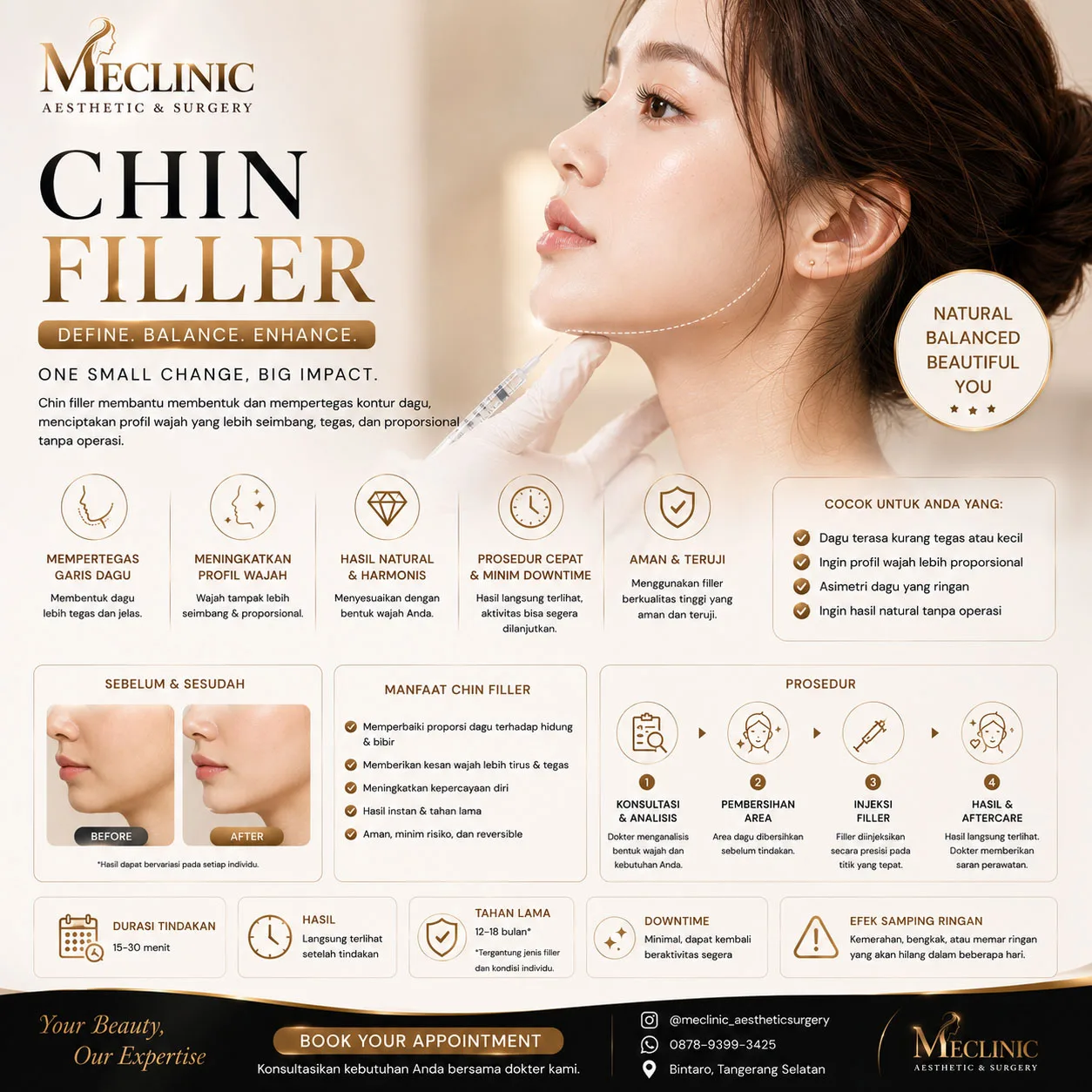 Chin Filler