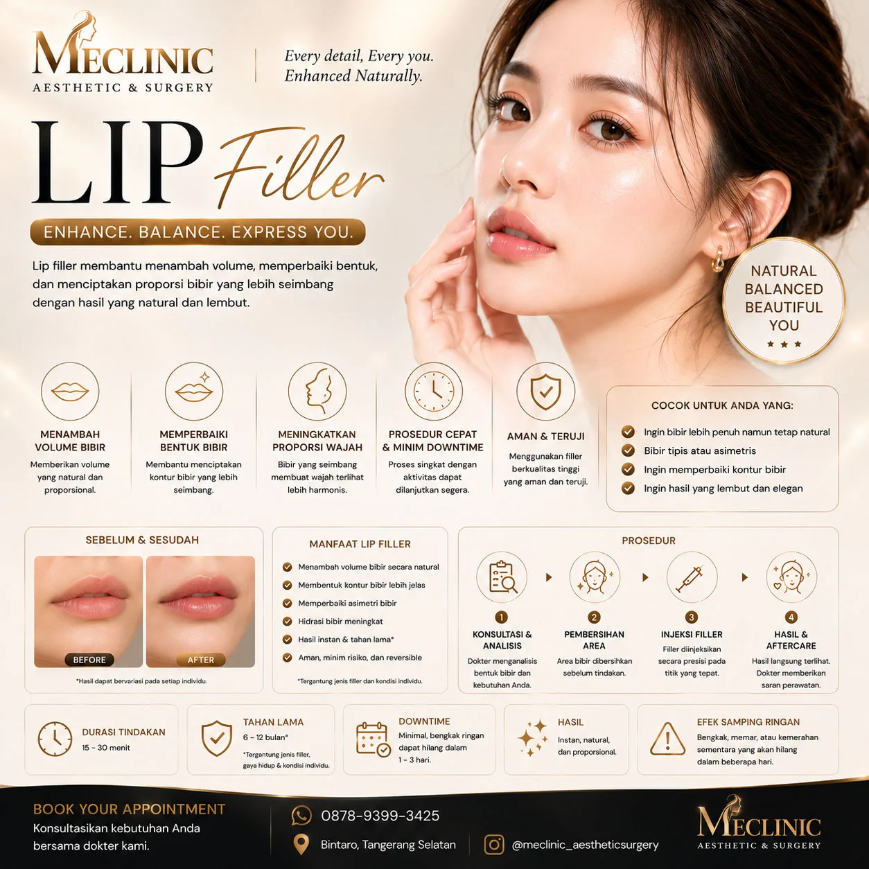 Lip Filler