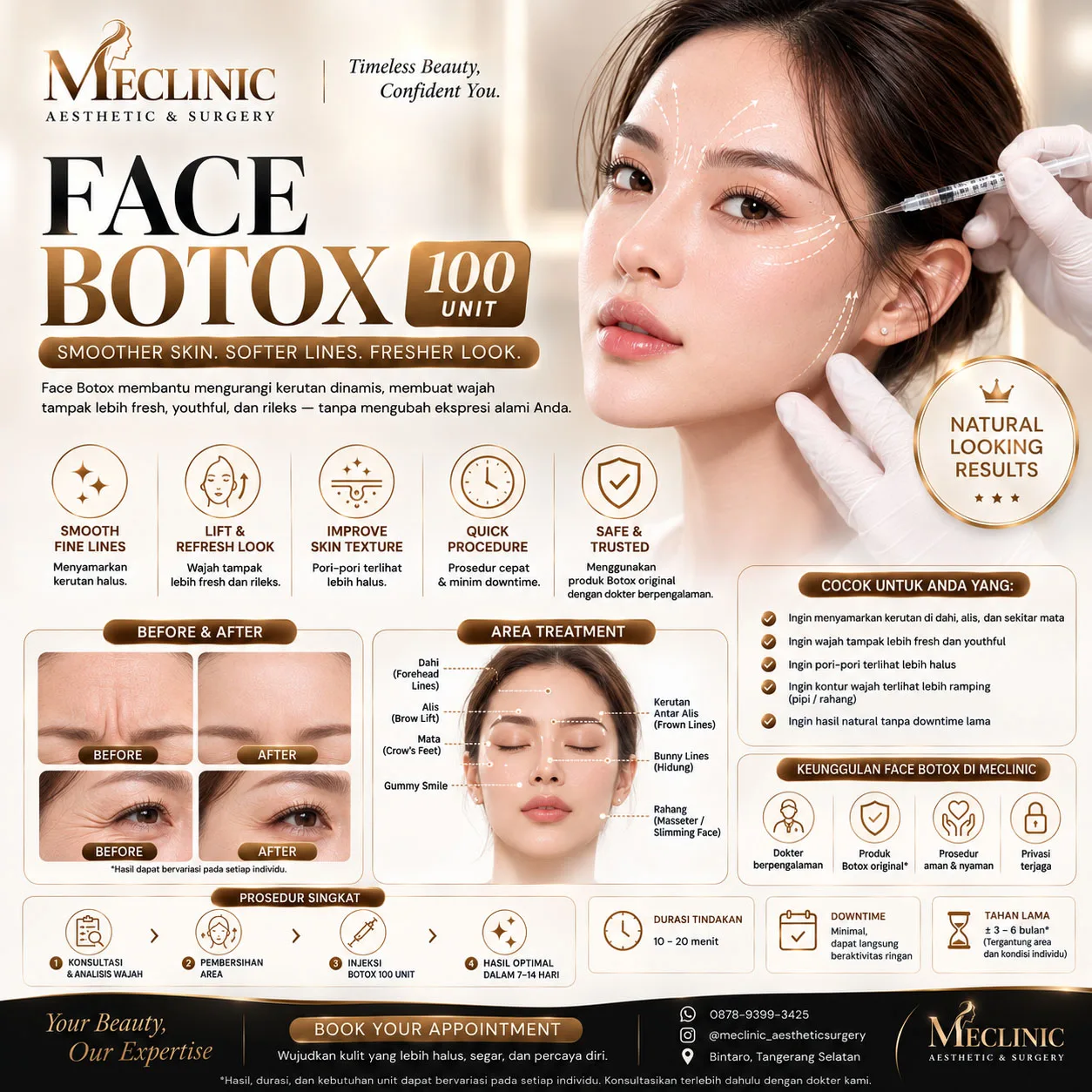 Face Botox 100 Unit