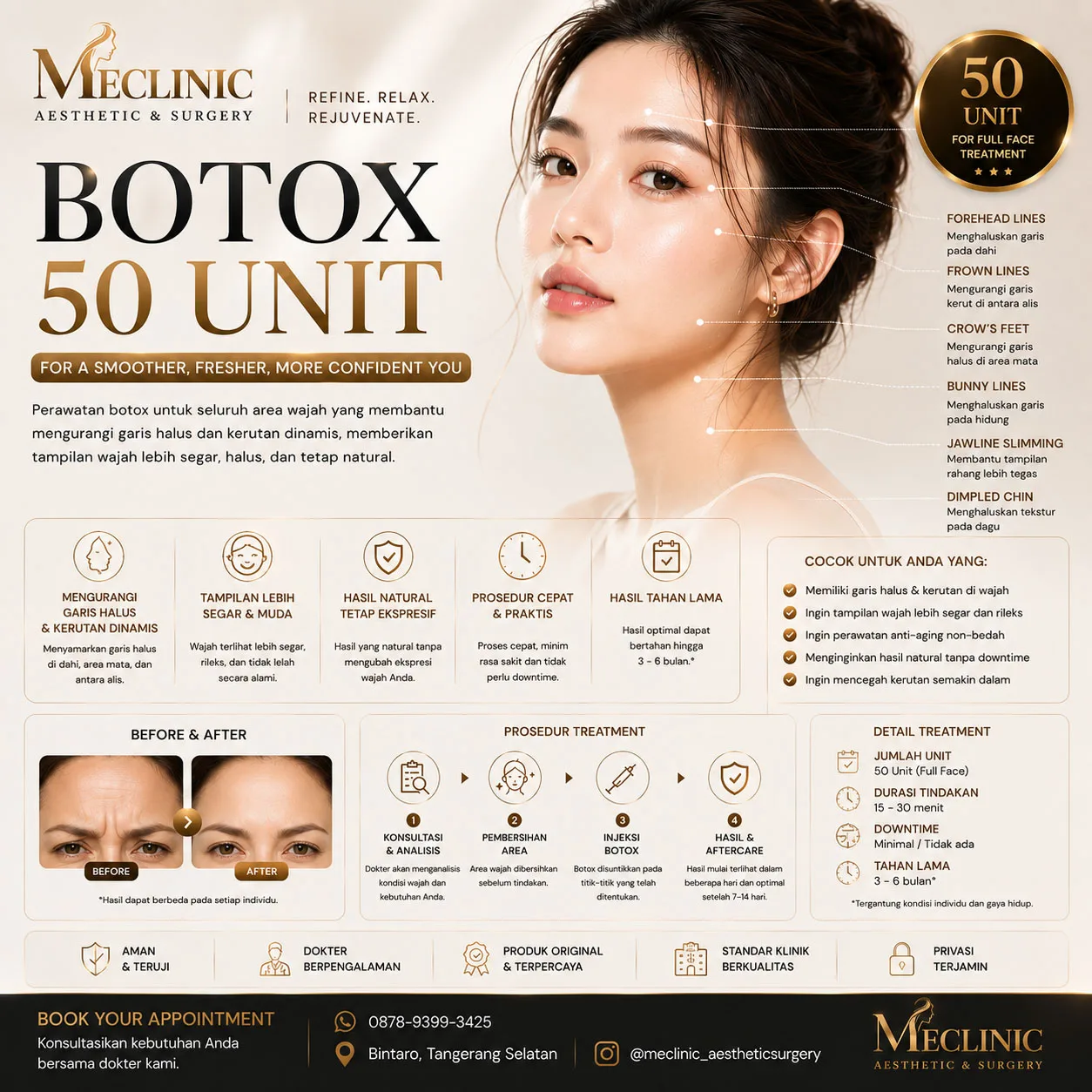 Face Botox 50 Unit