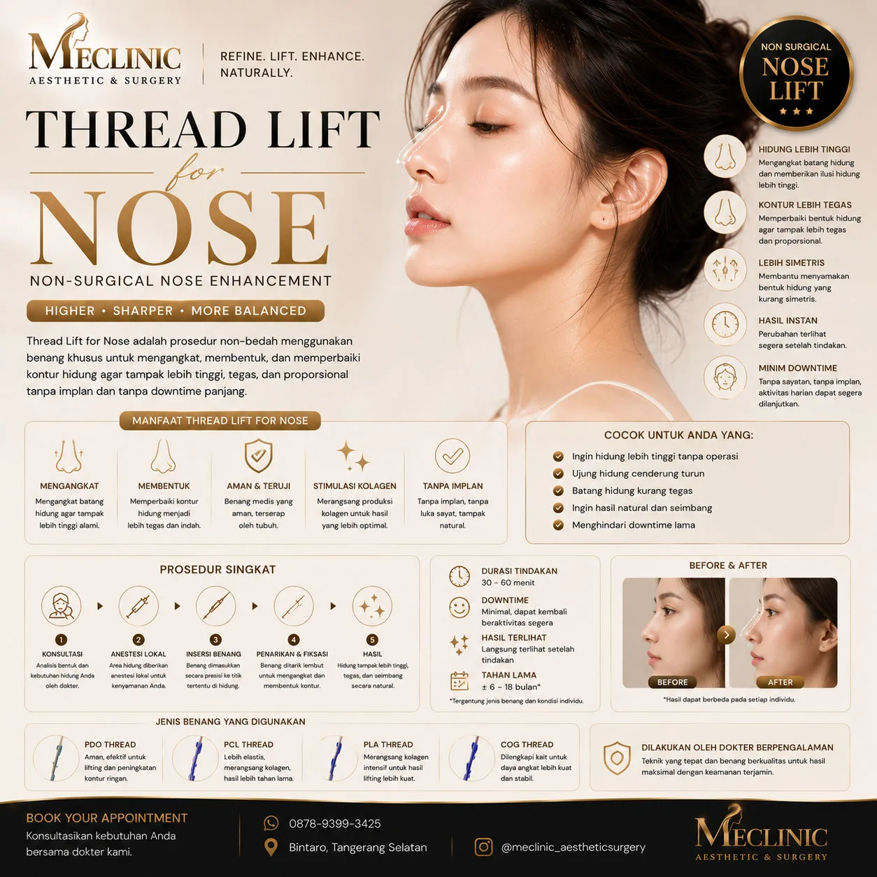 Thread Lift for Nose