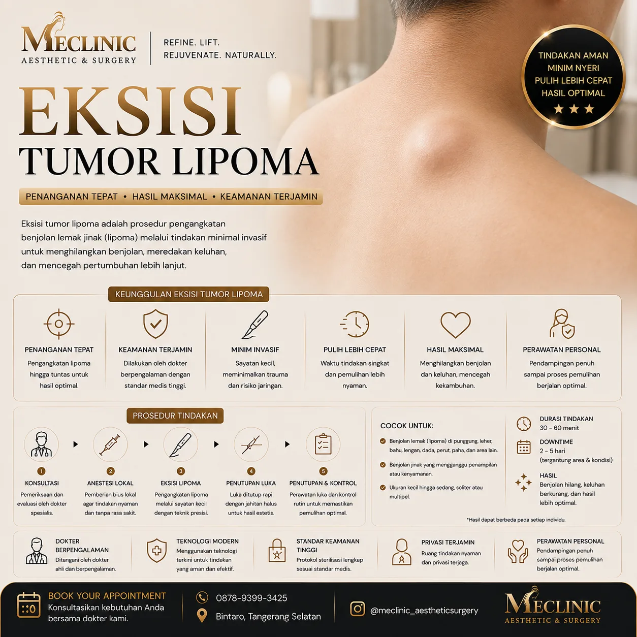 Eksisi Tumor Lipoma (Kecil)