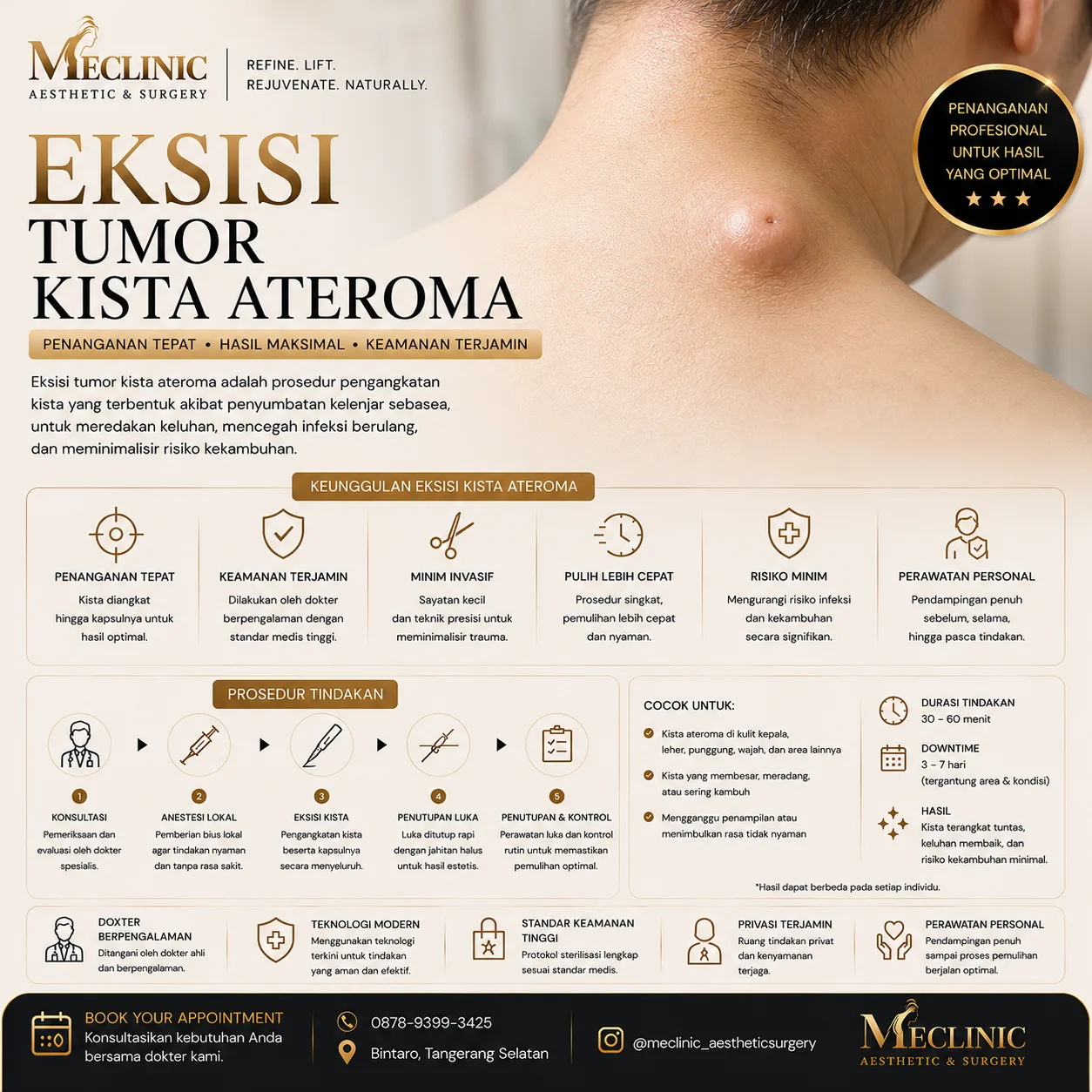 Eksisi Tumor Kista Ateroma (Besar)
