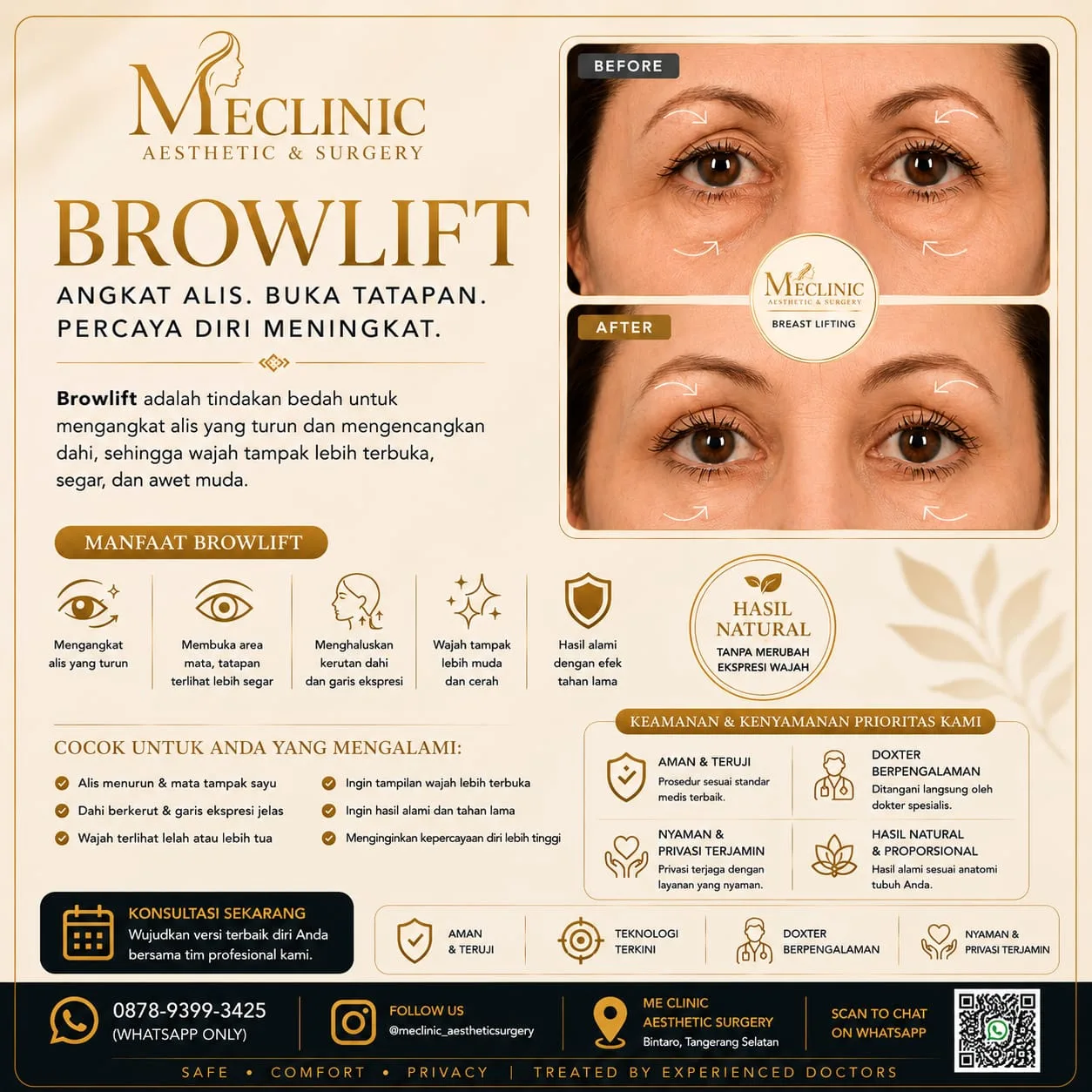Brow Lift