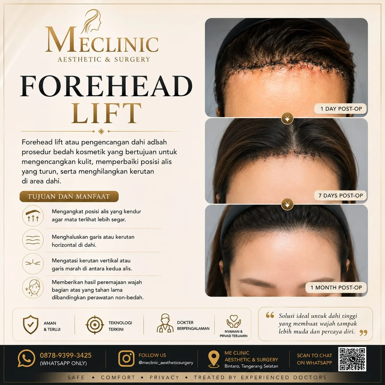 Forehead Lift